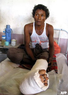 A landmine victim, Than Lwin, sits in his hospital bed in Mone village, some 160 kilometers north of Rangoon, in a file photo dated 2006. Photo: AFP 