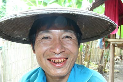 Shay Reh, of Karenni Refugee Camp 1, near Mae Hong Son, chews the betel nut every day, but, has tried to stop. Photo: Kantarawaddy Times