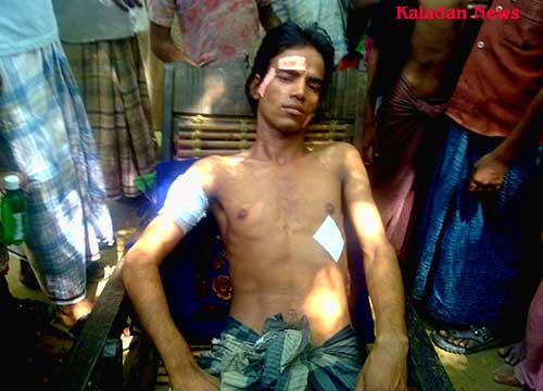 pic_2_Oziullah_20_stabbed_by_local_goons_while_he_was_entering_the_camp_illegal_way