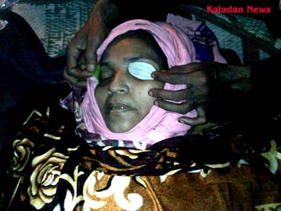 Nasima Khatun (50) died at Nayapara Refugee camp clinic without proper treatment refugeedead