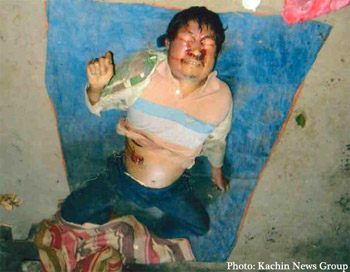 The body of Kachin farmer Manam Gam, shot and killed by Burmese soldiers in Manje (Mansi) Township on February 2. The body of Kachin farmer Manam Gam, shot and killed by Burmese soldiers in Manje (Mansi) Township on February 2.