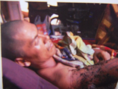 မြန်မာစစ်တပ်၏ရိုက်နှက်စစ်ဆေးသည့်လက်ချက်ကြောင့်ဒေသခံများသေကြေ၊ ဒဏ်ရာရ (ဓါတ်ပုံ- SSPP/SSA) မြန်မာစစ်တပ်၏ရိုက်နှက်စစ်ဆေးသည့်လက်ချက်ကြောင့်ဒေသခံများသေကြေ၊ ဒဏ်ရာရ (ဓါတ်ပုံ- SSPP/SSA)