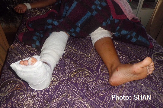 ၁၉ ရက်မနက်က ဗုံးနင်းမိသော ပကာကျေးရွာသူ နန်းအေးဌေး (ဓါတ်ပုံ-သျှမ်းသံတော်ဆင့်) ၁၉ ရက်မနက်က ဗုံးနင်းမိသော ပကာကျေးရွာသူ နန်းအေးဌေး (ဓါတ်ပုံ-သျှမ်းသံတော်ဆင့်)