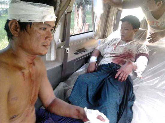 သံတွဲပဋိပက္ခဒဏ်ရာရသူ(NARINJARA) သံတွဲပဋိပက္ခဒဏ်ရာရသူ(NARINJARA)