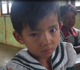 ဒေါဆော်ဘိကျေးရွာမှ မျက်စိနာရောဂါဝေဒနာ ခံစားနေရသော ကျောင်းသူတဦး (ဓါတ်ပုံ-ကေတီ) ဒေါဆော်ဘိကျေးရွာမှ မျက်စိနာရောဂါဝေဒနာ ခံစားနေရသော ကျောင်းသူတဦး (ဓါတ်ပုံ-ကေတီ)