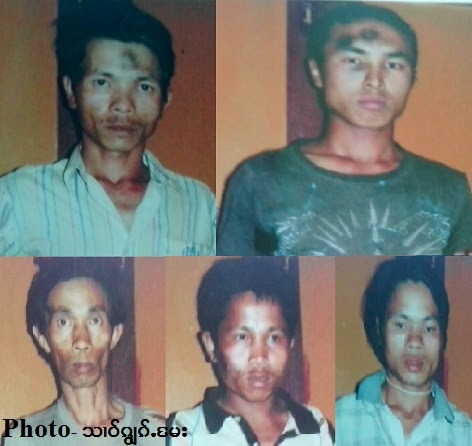 Shao Kyawkme) Shao Kyawkme)