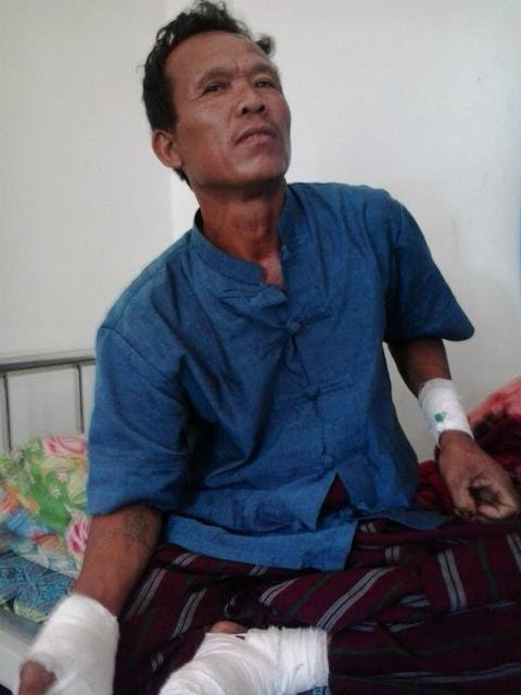 ကျားသစ်ကိုက်ခံရ၍ ဆေးကုသမှုခံယူနေသည့် ဦးထွန်းတင်မြင်တွေ့ရစဉ်။