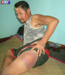 KNU/KNLA PC တပ်သာ စောဝင်းသိန်း IMG 040