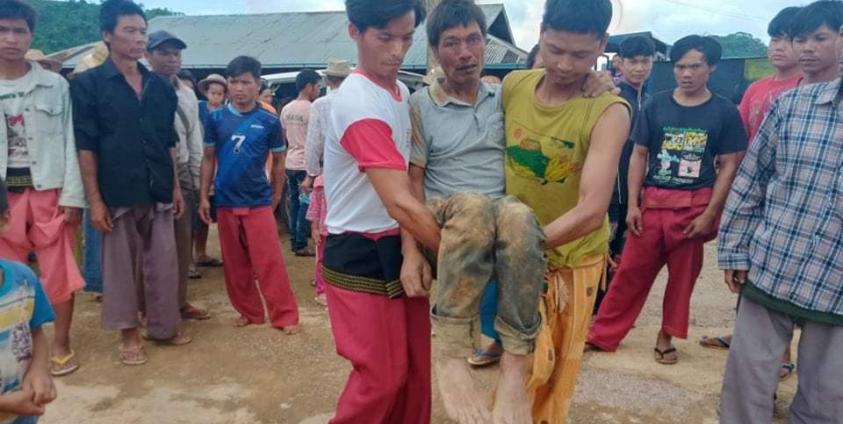 ရိုက်နှက်ခံထားရသည့် ဦးအိုက်မောင်ပုံ (ဓာတ်ပုံ ဒေသခံ တဦး)