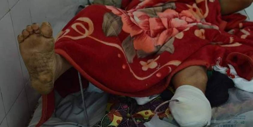 မိုင်းနင်းမိဒဏ်ရာရခဲ့သော ဒေသခံ