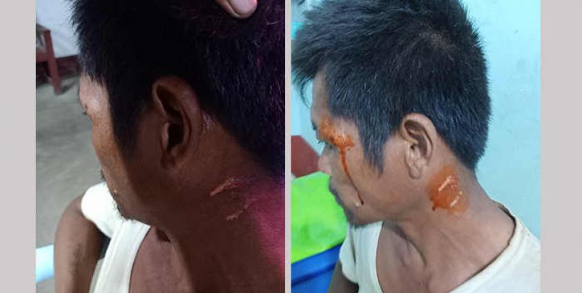 Photo by Sai One Leang Kham