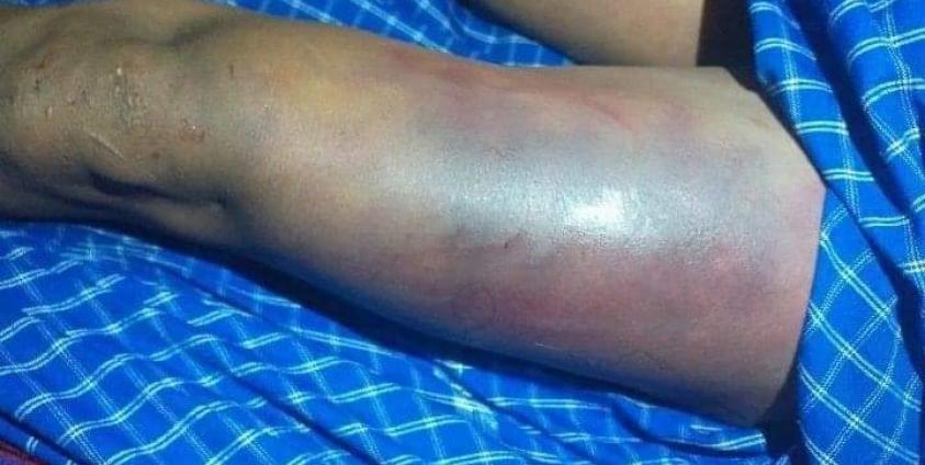 သေဆုံးသူ ဝင်းထွန်းရုပ်အလောင်းမှ ဒဏ်ရာအချို့(Fcaebook)