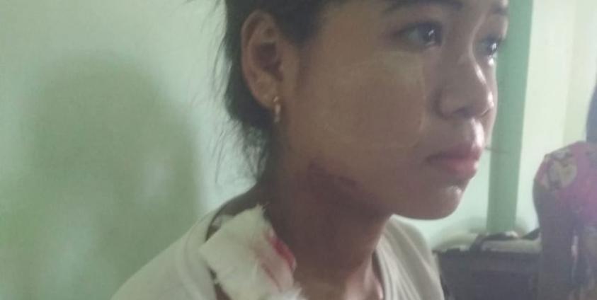 14-year-old hit by stray bullet in Ponnagyun Twsp