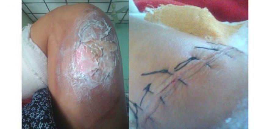 (ဓာတ်ပုံ – CHRO)