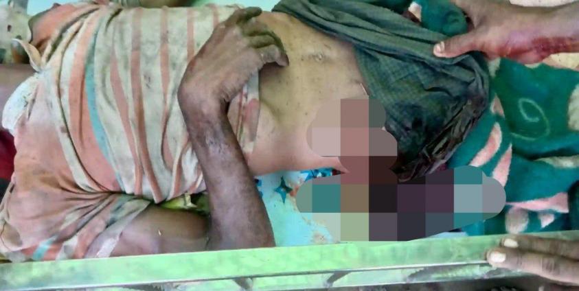 လက်နက်ကြီးကျည်စထိမှန်ခဲ့သည့် မာမတ်အီနစ်ကို တွေ့ရစဉ်။ ဓာတ်ပုံ - Arakan Princess Media