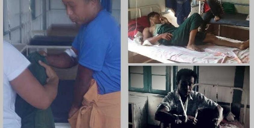 Photo by Kunhing- Landmine victims at the local hospital in Namtu Township.