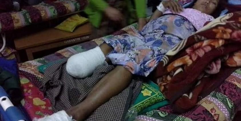 Photo by SHRF- Nang Khin Than Nu was injured by Burmese army air strike.