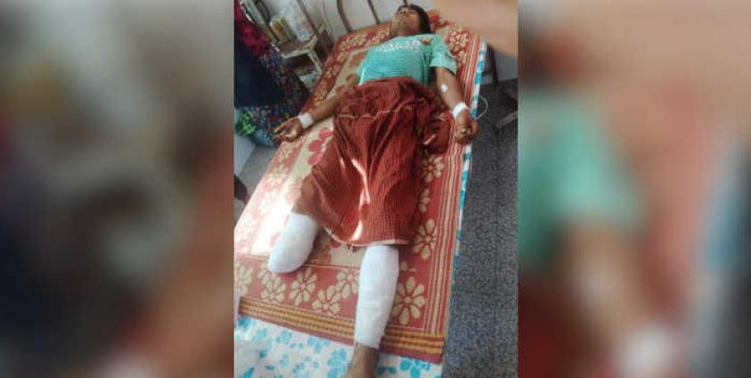 မြေမြှုပ်မိုင်းဒဏ်ခံရသူ နိုင်ဗိုင် (MNA)