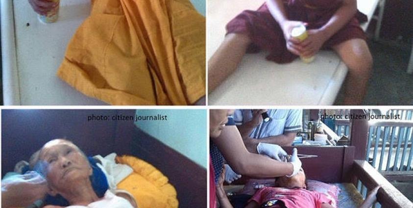 Four victims injured in a bomb explosion in Mong Hsu (S.H.A.N)