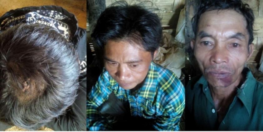Photo SHRF: three victim villagers who were beaten by Burmese army.