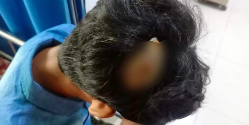 ကျောက်တော်ဆေးရုံသို့ပို့ဆောင်ထားသည့် လက်နက်ကြီးကျည် ထိဒဏ်ရာရ Photo - ဖြူစင်မေတ္တာပရဟိတအသင်းသူ ၃ ဦးအားတွေ့ရစဉ်။