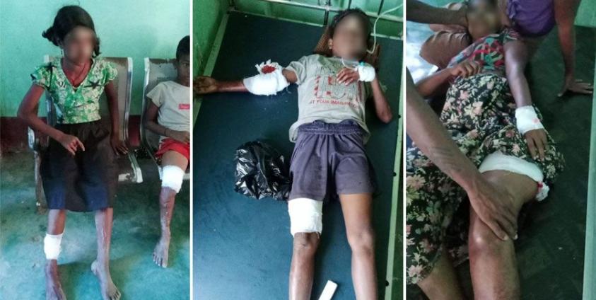 မင်းပြားမြို့ပေါ်တွင် ဒီဇင်ဘာ ၁၀ ရက်က လက်နက်ကြီးကျရောက်မှုကြောင့် မိန်းကလေးငယ် ၁ ဦး သေဆုံးကာ ၈ ဦး ဒဏ်ရာရရှိခဲ့သည်။  (ဓာတ်ပုံ - မာရယု)