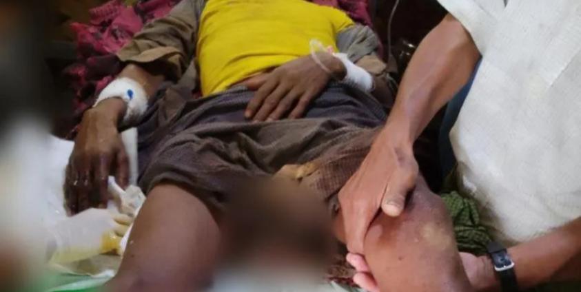 ဓာတ်ပုံ-APM