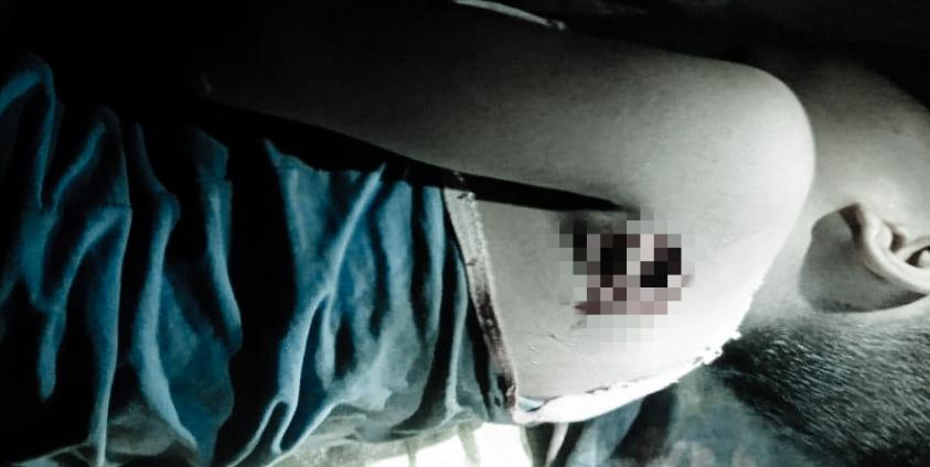 ကျောကုန်းတွင် လက်နက်ကြီးကျည်စထိမှန်၍ သေဆုံးခဲ့ရသည့် နဂရာကျေးရွာမှကလေးကိုတွေ့ရစဉ်။