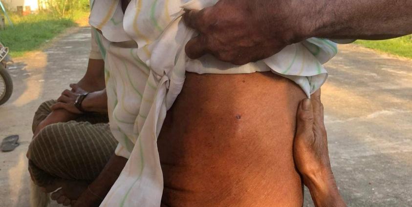 လက်နက်ကြီးကျည်စ ထိမှန်ခဲ့သည့် အမျိုးသားတစ်ဦး - ခေါဇာမြို့