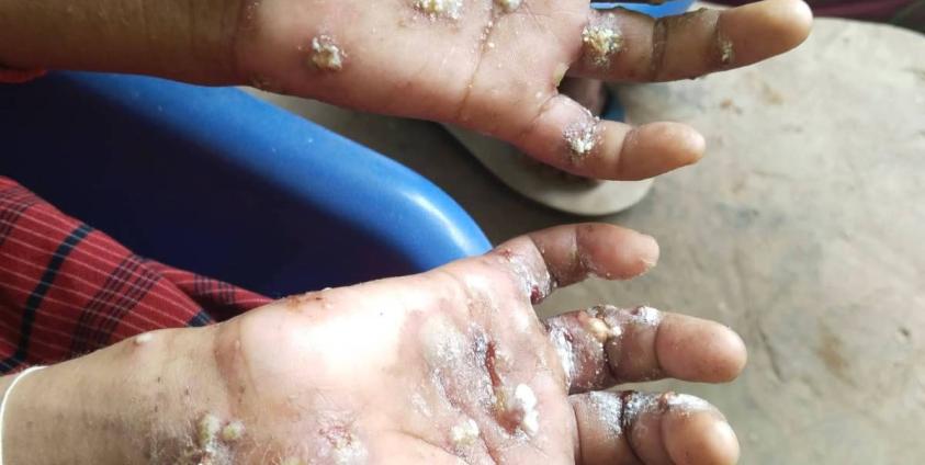 ဓါတ်ပုံ-ဒေသခံ