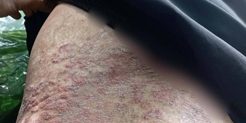 ဓါတ်ပုံ - Mg Bo (Facebook)