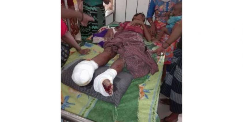 မြောက်ဦးမြို့နယ်၊ ပေါင်းတုတ်ကျေးရွာအနီးတွင် မိုင်းပေါက်ကွဲမှုကြောင့် ဒဏ်ရာရရှိသွားသည့် လူငယ်တစ်ဦးအားတွေ့ရစဉ်။ ဓာတ်ပုံ- ARE