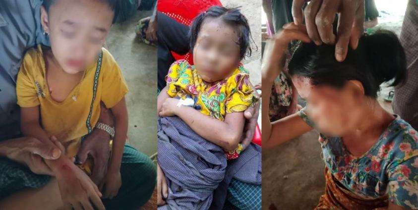 ယနေ့(နိုဝင်ဘာလ ၁၁ ရက်)တွင် လက်နက်ကြီးကျည်စထိမှန်သွားသည့် ရွှေပြည်သစ်ကျေးရွာမှ ဒေသခံများကို တွေ့ရစဉ်။