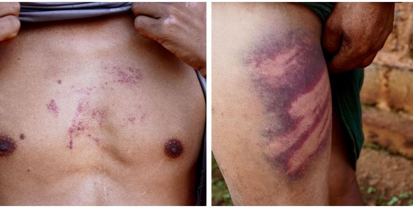 ရိုက်နှက်မှုကြောင့် ဒေသခံတဦး ဒဏ်ရာပြင်းထန်