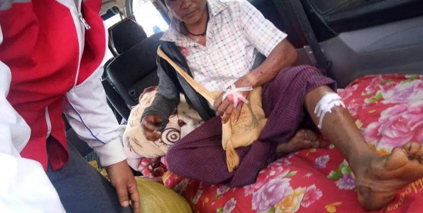 Photo by Tin Maung Thein/ ယမန်နေ့ တောင်ပလို့ ရွာသား မြေမြုပ်မိုင်း နင်းမိကာ ထိခိုက်ဒဏ်ရာရပုံ