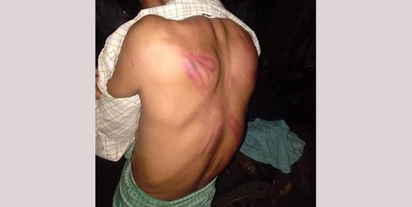 Photo by Namkham’s civil| Nyi Maung San the victim