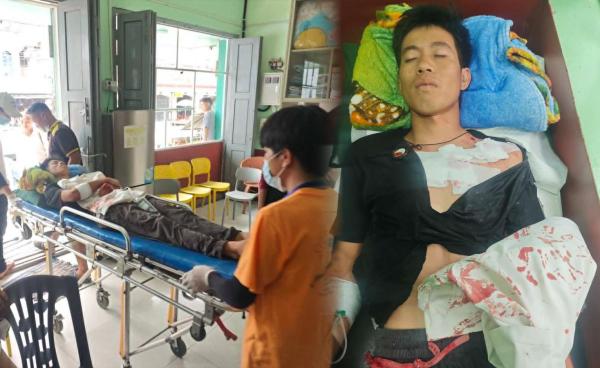 ဓာတ်ပုံ - (မူဆယ်-နမ့်ခမ်း လမ်းမပေါ် KIA တပ်သားက သေနတ်ဖြင့် ပစ်ခတ်ခဲ့သဖြင့် ဒဏ်ရာရရှိသွားသည့် အမျိုးသား / Crd)