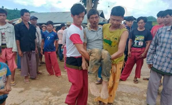 ရိုက်နှက်ခံထားရသည့် ဦးအိုက်မောင်ပုံ (ဓာတ်ပုံ ဒေသခံ တဦး)