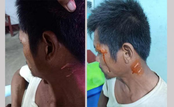 Photo by  Sai One Leang Kham