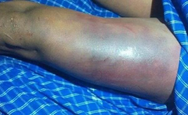 သေဆုံးသူ ဝင်းထွန်းရုပ်အလောင်းမှ ဒဏ်ရာအချို့(Fcaebook)