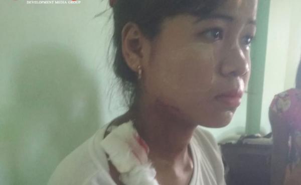 14-year-old hit by stray bullet in Ponnagyun Twsp