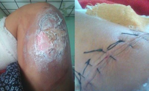 (ဓာတ်ပုံ – CHRO)