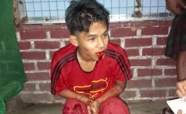 ဖမ်းဆီး ခံလိုက်ရသည့် လူငယ်တစ်ဦး