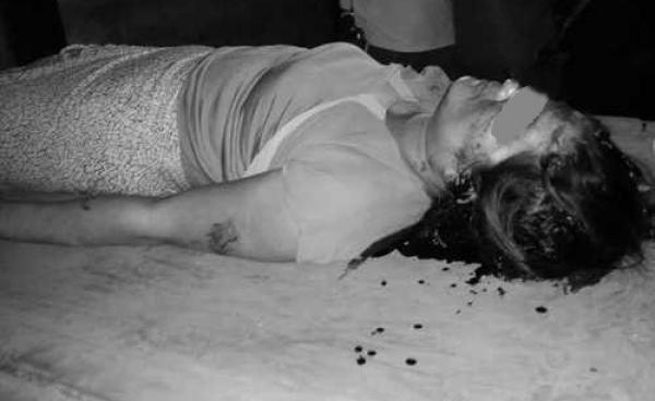 သနတ်ပစ်သတ်ခံအမျိုးသမီး(MNA)