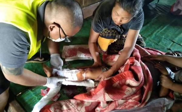 ကျောက်မဲ ဆယ်နှစ်အရွယ် (၂)ဦး မိုင်းနင်းမိ