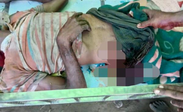 လက်နက်ကြီးကျည်စထိမှန်ခဲ့သည့် မာမတ်အီနစ်ကို တွေ့ရစဉ်။ ဓာတ်ပုံ - Arakan Princess Media