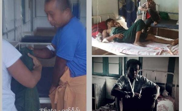 Photo by Kunhing- Landmine victims at the local hospital in Namtu Township.