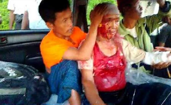  သေနတ် ထိမှန်သော ဦးဇိန်ဟန်ဘောက် Slg. Zinghang Bawk ကို တွေ့ရစဉ်