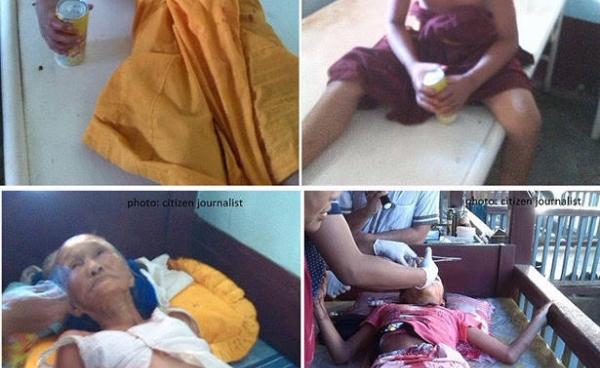 Four victims injured in a bomb explosion in Mong Hsu (S.H.A.N)