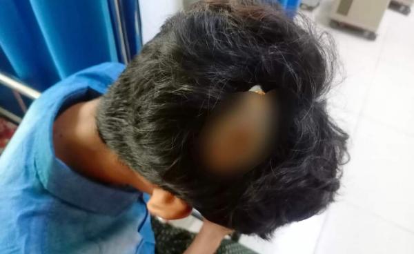 ကျောက်တော်ဆေးရုံသို့ပို့ဆောင်ထားသည့် လက်နက်ကြီးကျည် ထိဒဏ်ရာရ Photo - ဖြူစင်မေတ္တာပရဟိတအသင်းသူ ၃ ဦးအားတွေ့ရစဉ်။